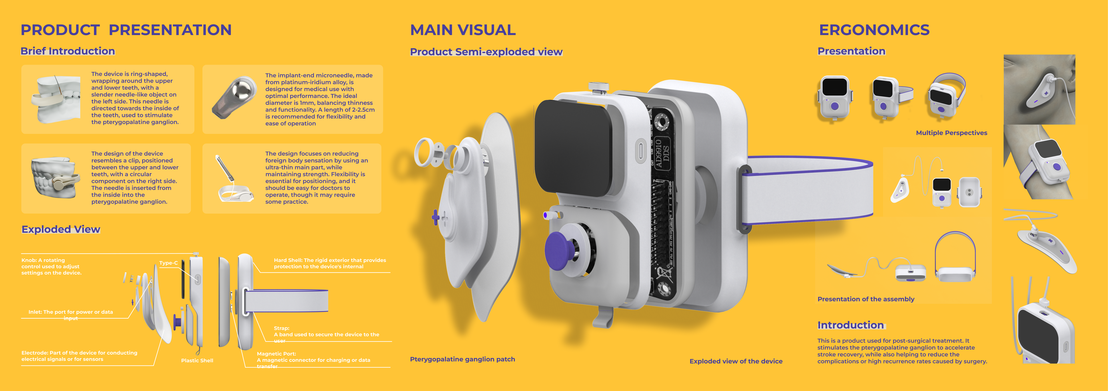 Xbrain — project page 5